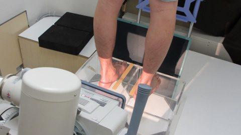日本初“足の検診”で足の健康維持＆パフォーマンスアップ！